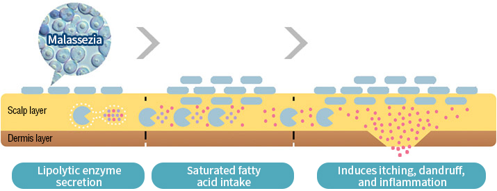 Lipolytic enzyme secretion → Saturated fatty acid intake → Induces itching, dandruff, and inflammation